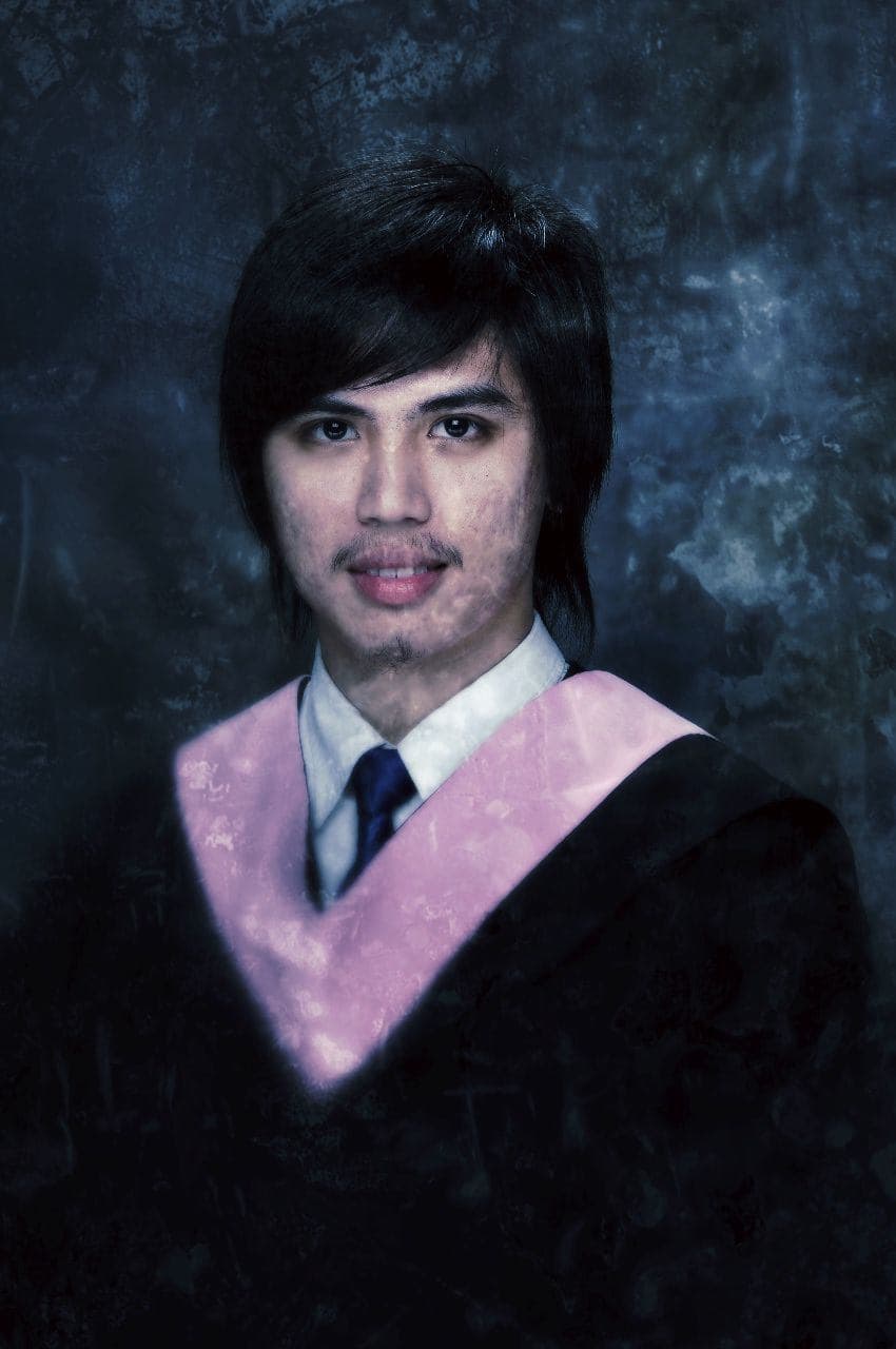 Adric graduated from University of Santo Tomas Philippines